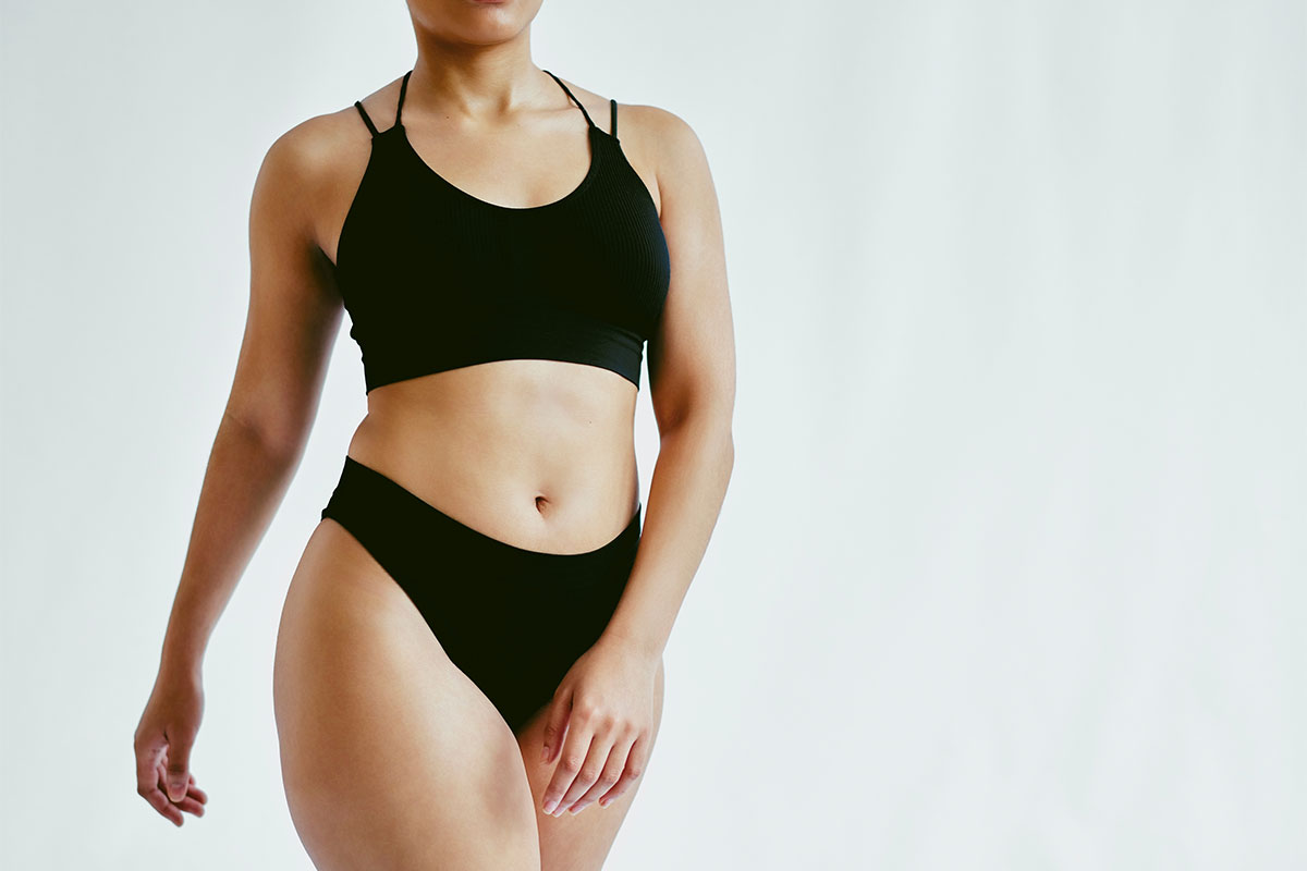 NYC patient after tummy tuck